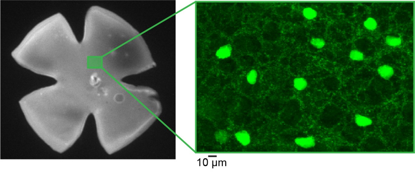 Left: a picture of retina Right: a GABAergic cell type visualized by GFP