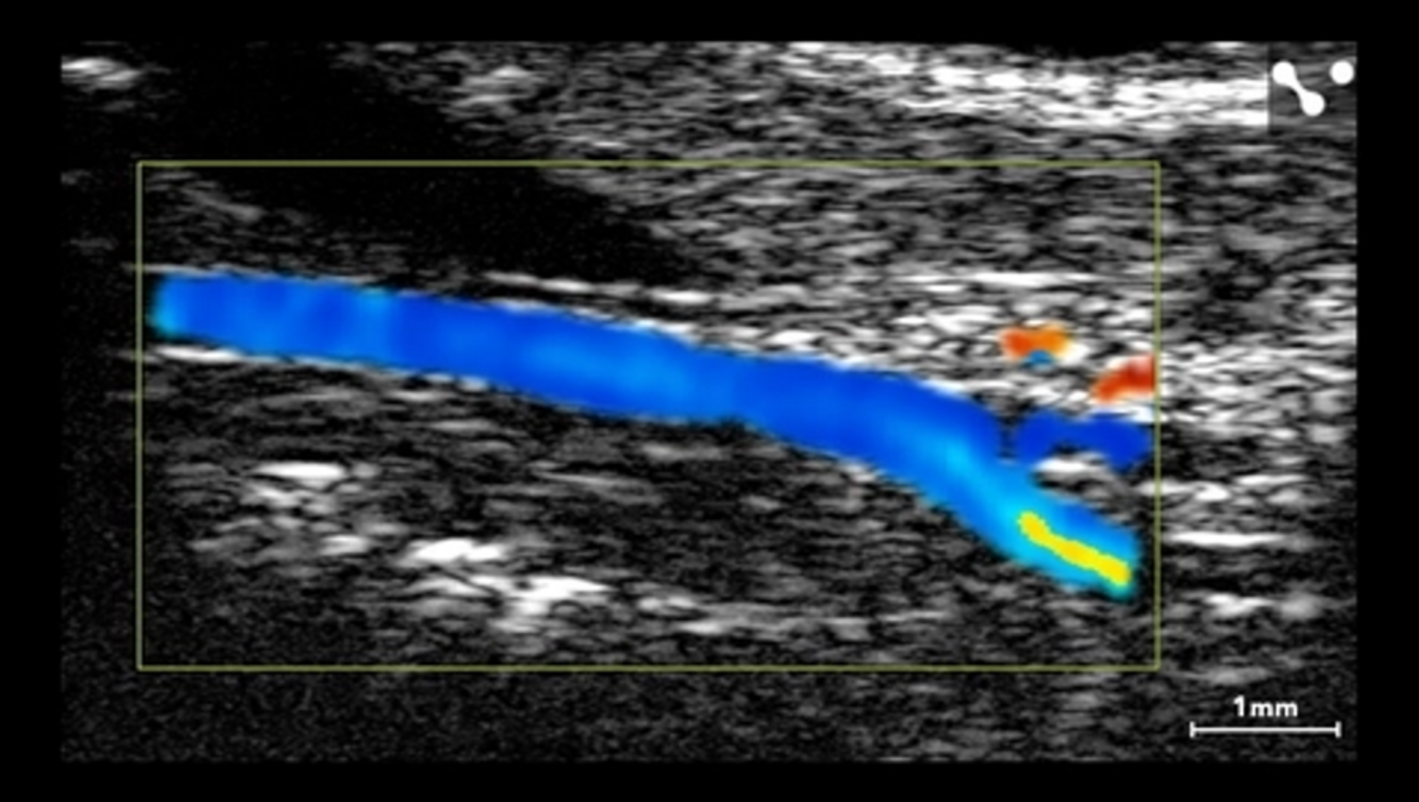 Murine Carotid Artery on Vevo F2 System; image FUJIFILM VisualSonics
