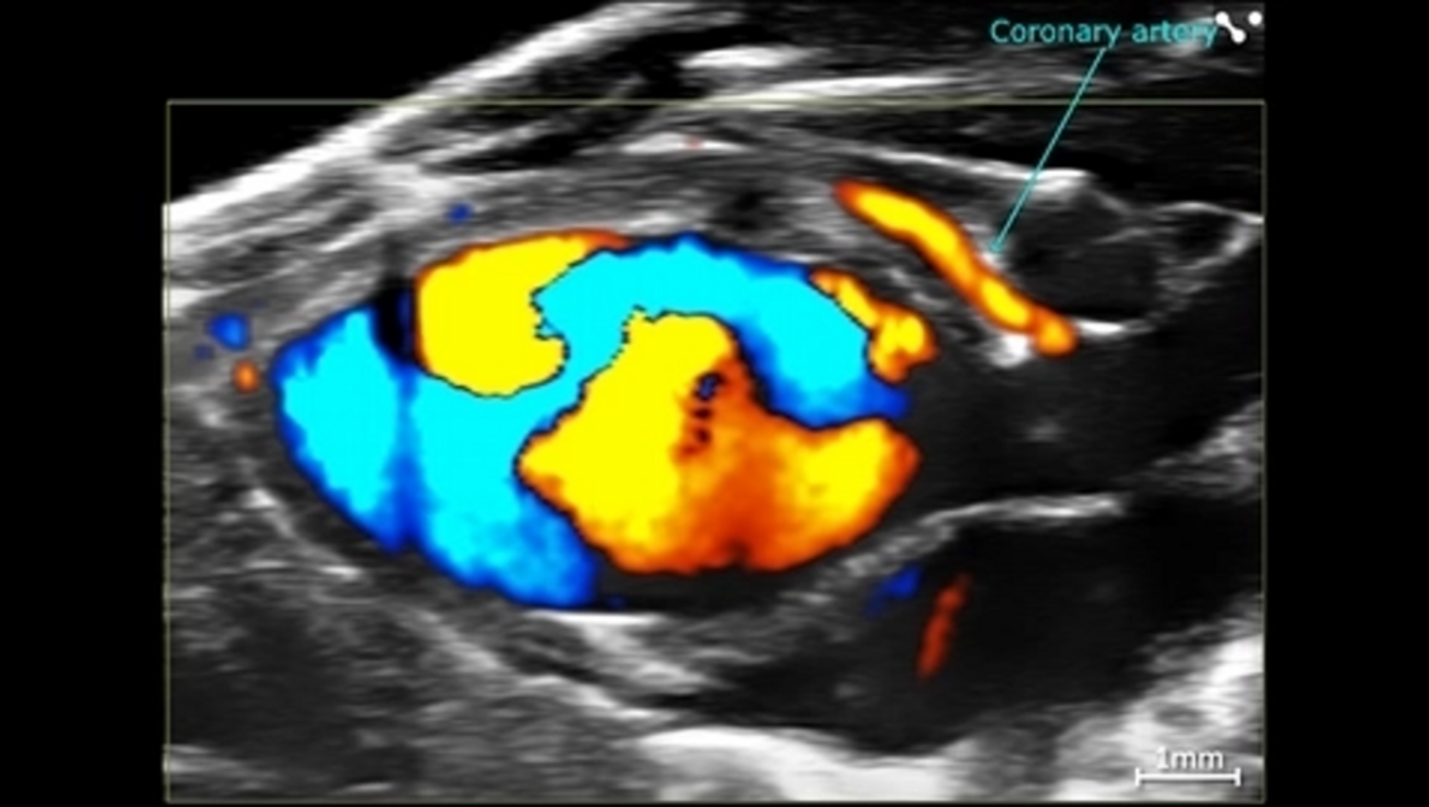 Cardiac Flow Dynamics and Coronary Artery, Color Doppler EKV on Vevo F2 System; image FUJIFILM VisualSonics