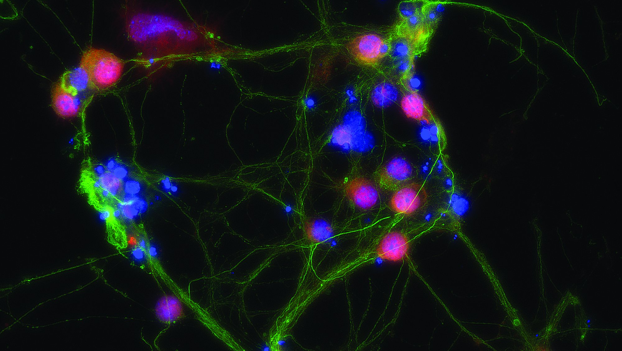 Neurons; HSV-3