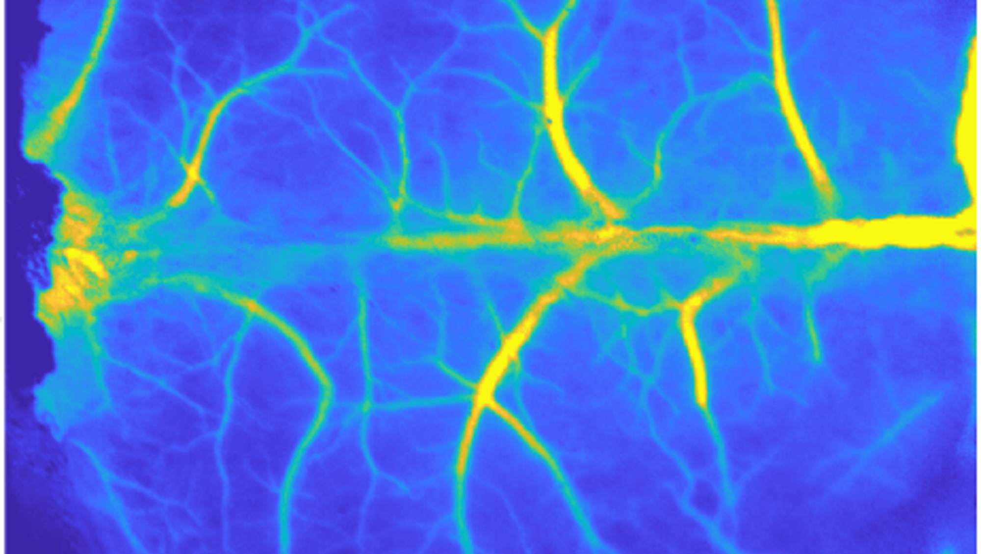 Laser Speckle Contrast Imaging of Mouse Brain; image Tarannum Ara