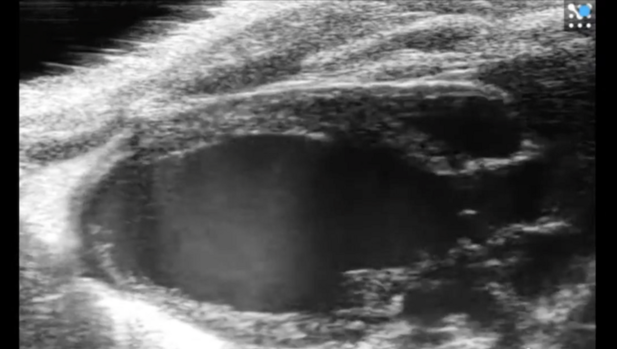 Parasternal Long Axis of Murine Left Ventricle on Vevo F2 System; image FUJIFILM VisualSonics