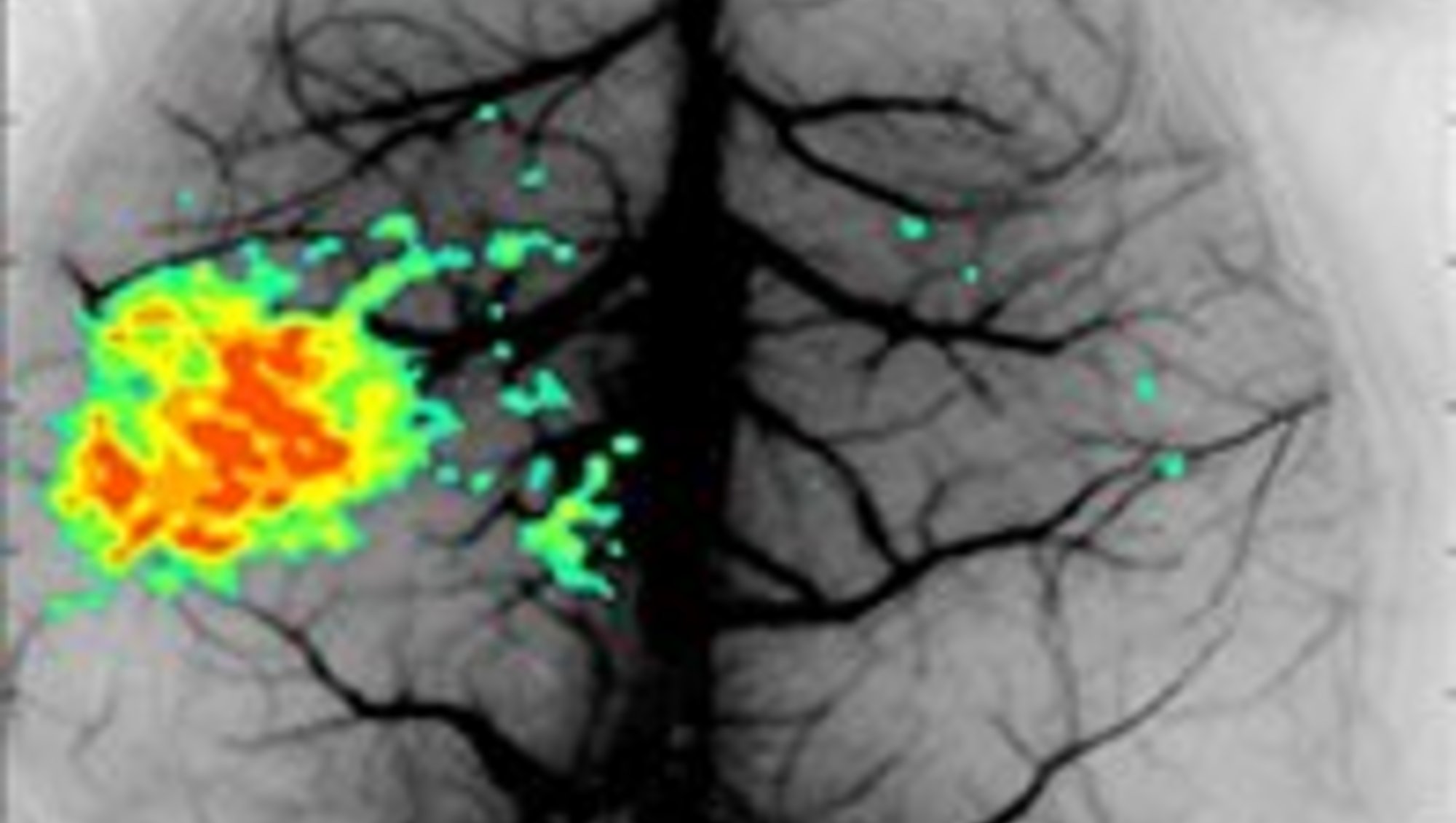 Laser Speckle Contrast Image; image by Christian Stæhr