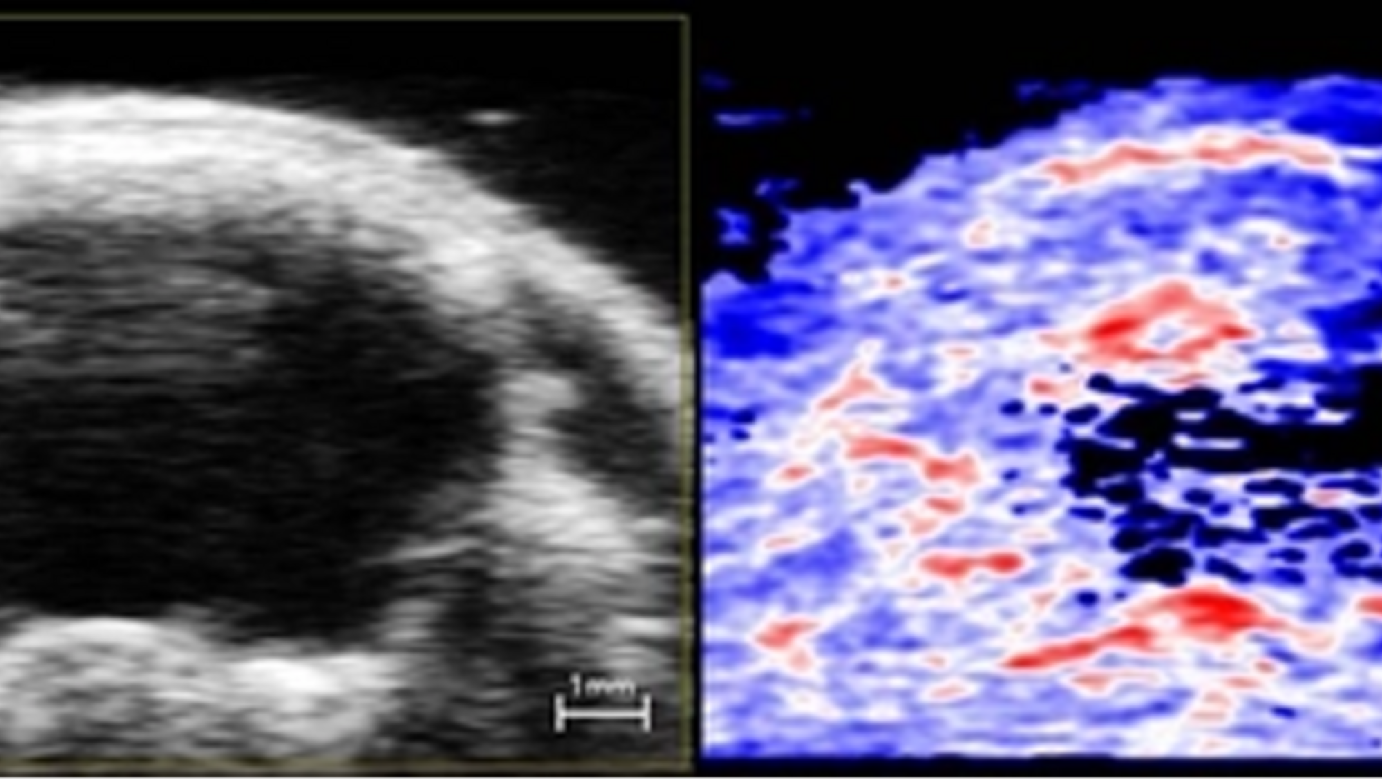 Ultrasound (left) and Photoacoustic (right) Coronal Images of Mouse Brain Post Ischemia/Hypoxia on Vevo F2 System; image by FUJIFILM VisualSonics