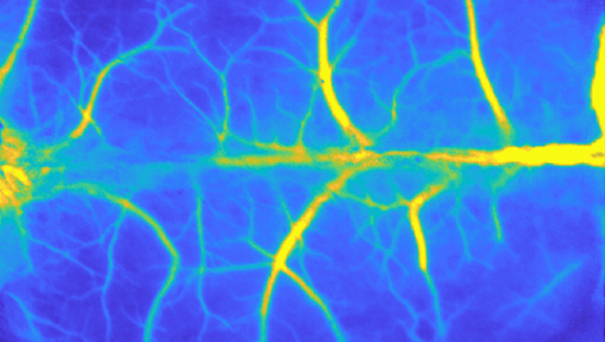 Mouse brain; laser speckle contrast imaging; image by Tarannum Ara