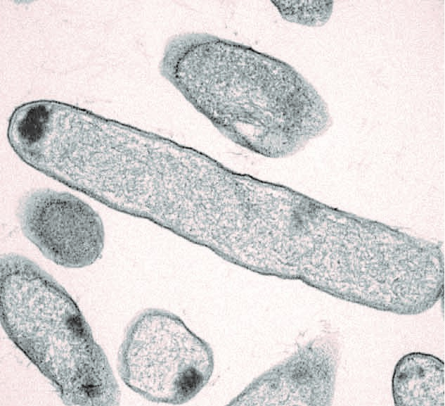 Pseudomonas aeruginosa-bakterien, som ofte findes i lungerne hos patienter med cystisk fibrose, kan slås ned med et gammelt præparat mod sklerose. Pseudomonas aeruginosa-bakterie